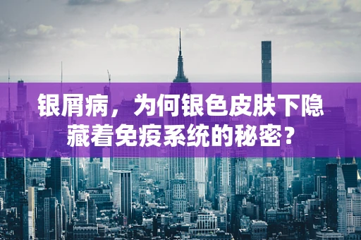 银屑病，为何银色皮肤下隐藏着免疫系统的秘密？