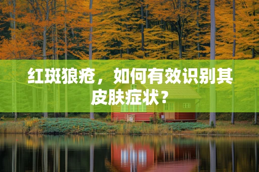 红斑狼疮，如何有效识别其皮肤症状？